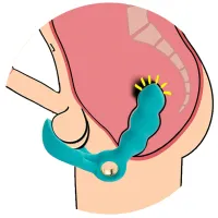 Masaj prostată și perineu cu două motoare - 36 de funcții intense - 73733260 - 2